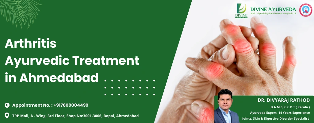 Arthritis Ayurvedic Treatment in Ahmedabad